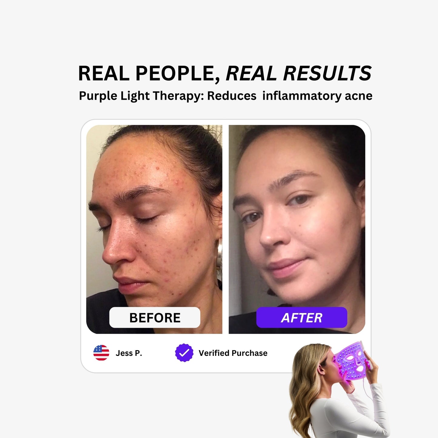 Luxe LED Mask